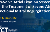 TCT 947: AltaValve Atrial Fixation System for Treatment of Severe Atrial Functional Mitral Regurgitation