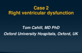 Topic 2:  Right Ventricular Dysfunction and Therapy Choice
