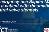 TCT 1498: Emergency Use M3 in a Patient With Rheumatic Mitral Valve Stenosis