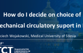 How Do I Decide on Choice of Mechanical Circulatory Support in MI: A Personal Perspective