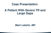 Case Presentation: A Patient With Severe TR and Large Gaps