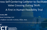 TCT 919: EasyCross Self-Centering Catheter to Facilitate Aortic Valve Crossing During TAVR: A First in Human Feasibility Trial