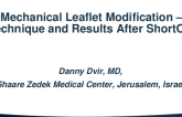 Mechanical Leaflet Modification – Technique and Results After SHORTCUT