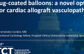 TCT 1536: Drug-Coated Balloons: A Novel Option for Cardiac Allograft Vasculopathy
