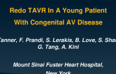 Redo TAVR in a Young Patient With Congenital AV Disease