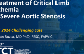 TCT 1373: Treatment of Critical Limb Ischemia in Severe Aortic Stenosis