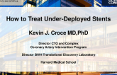 How to Treat Under-Deployed Stents