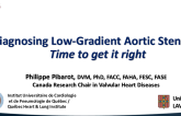 Diagnosing Low Gradient Aortic Stenosis: Time to Get It Right