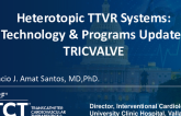 TricValve