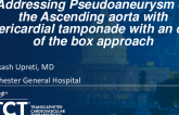TCT 1265: Addressing Pseudoaneurysm of the Ascending Aorta With Pericardial Tamponade With an Out of the Box Approach
