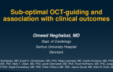 TCT 670: Sub-optimal OCT-guiding and Association with Two-year Clinical Outcomes - An OCTOBER Trial Substudy