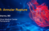 Delayed Annular Rupture