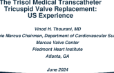 The Trisol Medical TTVR System: US Experience