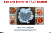 Tips and Tricks for TAVR Explantation