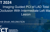 TCT 1116: Imaging Guided PCI of LAD Total Occlusion With Intermediate Left Main Lesion