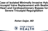 A Case of Isolated Minimally Invasive Hybrid Tricuspid Valve Replacement With Beating Heart and Cardiopulmonary Bypass for Secondary Tricuspid Regurgitation