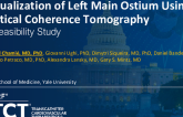 TCT 855: Visualization of Left Main Ostium Using Optical Coherence Tomography: A Feasibility Study