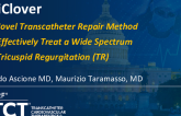 TCT 975: TriClover: A Novel Transcatheter Technique to Repair the Tricuspid Valve With High Potential for Effectiveness and Wide Indications to Treat Tricuspid Regurgitation (TR)
