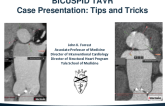 Case Presentation:  Bicuspid Tips and Tricks