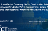 TCT 1185: Coronary Obstruction After Transcatheter Aortic Valve Implantation With a High-Frame Transcatheter Heart Valve: A Word of Caution