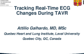 Tracking Real-Time ECG Changes During TAVR