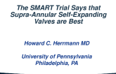 SMART Says That Self Expanding Valves Are Best!