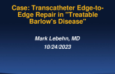 Case:  Transcatheter Edge-to-Edge Repair in "Treatable" Barlow's Disease