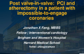 Post valve-in-valve:  PCI and atherectomy n a patient with impossible-to-engage coronaries 