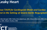 TCT 1173: A Leaky Heart: Post-Cardiac Arrest Transcatheter Aortic Valve Implantation (TAVI)  