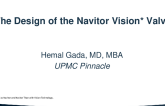The Design of the Navitor Vision Valve