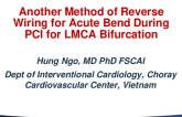 TCT 825: Another Method Of Reverse Wiring For A Very Acute Bend During PCI For LMCA Bifurcation