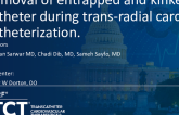 TCT 1402: Removal of Entrapped and Kinked Catheter During Trans-Radial Cardiac Catheterization by Snaring and Unwinding via Femoral Access