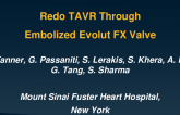 Redo TAVR Through Embolized Evolut FX Valve