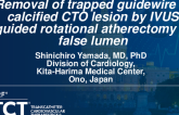 TCT 1279: Removal of Trapped Guidewire in Calcified CTO Lesion by IVUS Guided Rotational Atherectomy in False Lumen