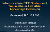 Intraprocedural Tee Guidance For LAAO Using Standard 2D Echo Views and 3D Echo