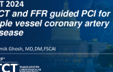 TCT 1304: OCT and FFR Guided PCI for Triple Vessel Disease