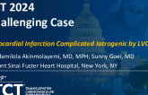 TCT 1527: Myocardial Infarction Complicated by Iatrogenic Left Ventricular Outflow Tract Obstruction
