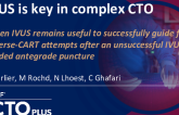 When IVUS Remains Useful to Successfully Guide Failed Reverse-CART Attempts After an Unsuccessful IVUS-Guided Antegrade Puncture
