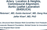 Aortic Cusps/CA Location/Heights/Commissural Alignment/Demo of Leaflet Laceration with Discussion