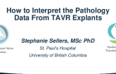 How to Interpret the Pathology Data From TAVR Explants