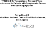 Transcatheter Tricuspid Valve Replacement - TRISCEND II