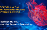 Backbeat Clinical Trial Program (Pacemaker-Mediated Blood Pressure Lowering)