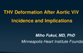 Next Frontier Insights: THV Deformation After ViV Procedures – Incidence and Implications