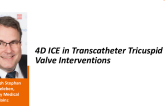 4D ICE in Transcatheter Tricuspid Valve Interventions