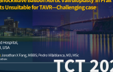 TCT 791: Triple Shockwave Balloon Aortic Valvuloplasty for Durable Results in Frail Patients Unsuitable for TAVR