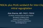 TCT 964: First reported case of a PASCAL plus PLUG sandwich for Inter-Clip mitral regurgitation.