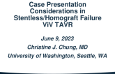Case Presentation 2:  Considerations in Stentless/Homograft Failure ViV TAVR