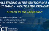 TCT 1306: Challenging Intervention in a Case of LT Hand: Acute Limb Ischemia With a Rare Etiology