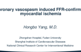 TCT 1080: Coronary Vasospasm Induced FFR-Confirmed Myocardial Ischemia