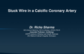 TCT 1546: Stuck Wire in a Calcific Coronary Artery